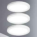 Lumare LED Deckenleuchte Dimmbar | 12W | 800 Lumen | Ø170mm Rund | Deckenlampe Modern | Warmweiß 3.000K | Einbau - u. Aufbaulampe Extra Flach 18mm für Wohnzimmer, Bad, Flur uvm. | IP44 | 3er Set